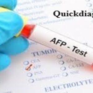 Quickdiagno AFP-ALPHA FETO PROTEIN Test