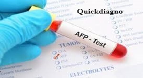 Quickdiagno AFP-ALPHA FETO PROTEIN Test