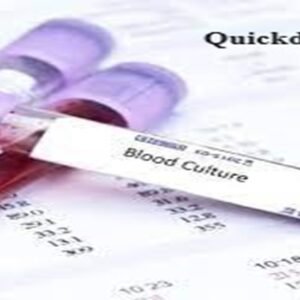 Quickdiagno BLOOD CULTURE Test