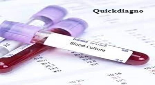 Quickdiagno BLOOD CULTURE Test