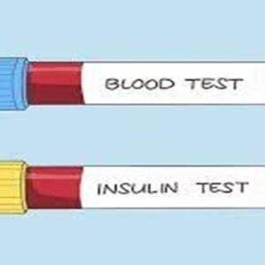 Quickdiagno INSULIN-RANDOM