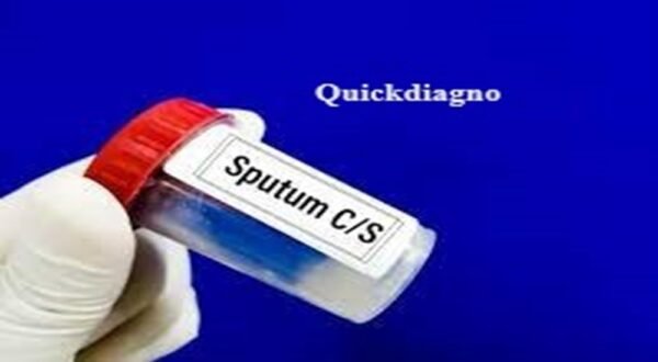 Quickdiagno sputum Test