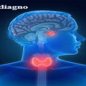 Quickdiagno TSH (THYROID STIMULATING HORMONES)