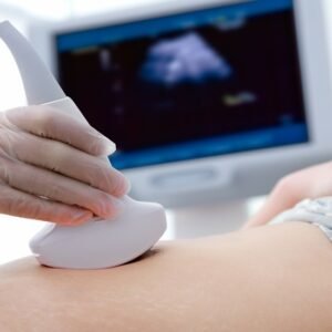 Quickdiagno Ultrasound sonography