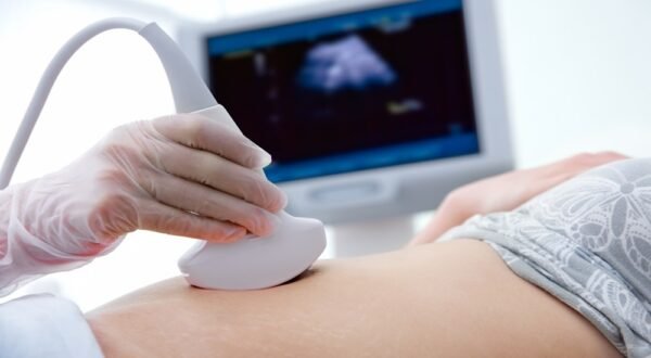 Quickdiagno Ultrasound sonography